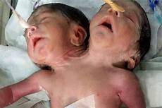 Newborn Baby Store